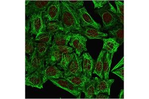 Immunofluorescent staining of methanol-fixed HeLa cells. (Cytokeratin 7 antibody)