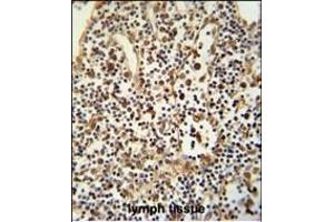 ANO5 Antibody (C-term) (ABIN652521 and ABIN2842350) immunohistochemistry analysis in formalin fixed and paraffin embedded human lymph tissue followed by peroxidase conjugation of the secondary antibody and DAB staining. (Anoctamin 5 antibody  (C-Term))