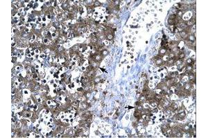 Image no. 3 for anti-Matrix Metallopeptidase 19 (MMP19) (AA 349-398) antibody (ABIN202685) (MMP19 antibody  (AA 349-398))