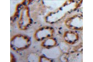Used in DAB staining on fromalin fixed paraffin-embedded kidney tissue (PKC alpha antibody  (AA 339-597))