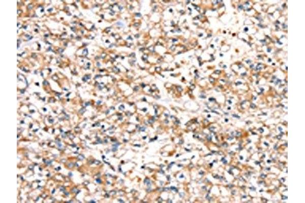 SLC24A3 antibody