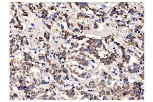 IHC analysis of PFKFB2 using anti-PFKFB2 antibody (ABIN7601627).