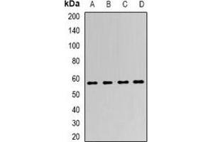 Western blot analysis of LSF expression in SKOV3 (A), K562 (B), mouse kidney (C), mouse brain (D) whole cell lysates. (TFCP2 antibody)