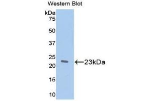 Western Blotting (WB) image for anti-Retinol Binding Protein 5, Cellular (RBP5) (AA 19-201) antibody (ABIN1078489) (Retinol Binding Protein 5 antibody  (AA 19-201))