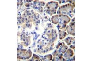 Formalin fixed, paraffin embedded human pancreas tissue stained with SMAP2 Antibody  followed by peroxidase conjugation of the secondary antibody and DAB staining. (SMAP2 antibody  (Middle Region))