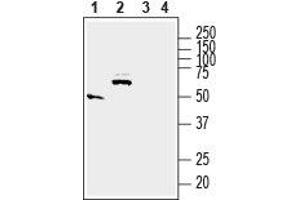 Western blot analysis of rat small intestine (lanes 1 and 3) and brain (lanes 2 and 4) lysates: - 1,2. (Solute Carrier Family 17 (Acidic Sugar Transporter), Member 5 (SLC17A5) (AA 479-492), (C-Term), (Intracellular) antibody)