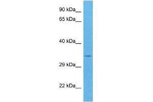 Host:  Rabbit  Target Name:  POPDC3  Sample Tissue:  Human HCT116 Whole Cell  Antibody Dilution:  1ug/ml (POPDC3 antibody  (C-Term))