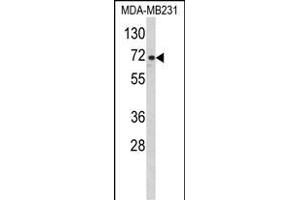 Western blot analysis of ARHG Antibody (Center) (ABIN652455 and ABIN2842309) in MDA-M cell line lysates (35 μg/lane).