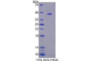 SDS-PAGE analysis of Human TSTA3 Protein.