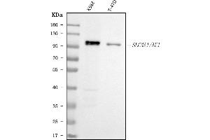 Western blot analysis of SLC4A1 using anti-SLC4A1 antibody (ABIN3043930). (Band 3/AE1 antibody  (AA 28-365))