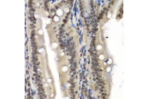 Immunohistochemistry of paraffin-embedded mouse Intestine using NELFE antibody at dilution of 1:100 (x40 lens). (RDBP antibody)