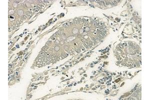 ABIN6260603 and ABIN6266446 at 1/100 staining human normal colon tissue by IHC-P.