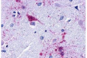 Anti-EDG7 antibody  ABIN1048536 IHC staining of human brain, amygdala. (LPAR3 antibody  (Cytoplasmic Domain))
