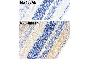 Immunohistochemistry (IHC) image for anti-Epidermal Growth Factor Receptor (EGFR) (C-Term) antibody (ABIN6254171)