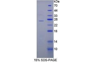 SDS-PAGE (SDS) image for Amyloid P Component, Serum (APCS) (AA 22-222) protein (His tag) (ABIN1878368) (APCS Protein (AA 22-222) (His tag))
