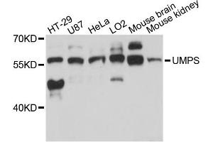 Western blot analysis of extracts of various cell lines, using UMPS antibody (ABIN6291043) at 1:3000 dilution. (UMPS antibody)