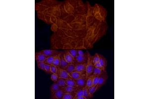 Immunofluorescence (IF) image for anti-Melanoma Cell Adhesion Molecule (MCAM) (AA 447-646) antibody (ABIN6143621)