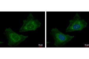 ICC/IF Image RABGGTB antibody detects RABGGTB protein at cytoplasm by immunofluorescent analysis.
