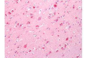 Human Brain, Cortex: Formalin-Fixed, Paraffin-Embedded (FFPE) (CNR1 antibody  (Cytoplasmic Domain))