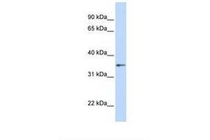 anti-Guanine Nucleotide Binding Protein (G Protein), beta Polypeptide 1 (GNB1) (AA 254-303) antibody