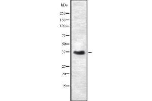 Western blot analysis of CEACAM6 using COLO205 whole cell lysates (CEACAM6 antibody)