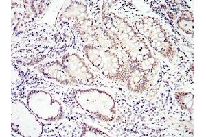 Immunohistochemistry (IHC) image for anti-SMAD Family Member 4 (SMAD4) antibody (ABIN969403)