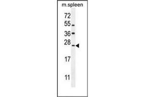 Western blot analysis of LMO4 Antibody (Center) in mouse spleen tissue lysates (35ug/lane). (LMO4 antibody  (Middle Region))