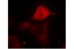 Image no. 1 for anti-Mitogen-Activated Protein Kinase Kinase 3 (MAP2K3) (pSer189) antibody (ABIN196863) (MAP2K3 antibody  (pSer189))