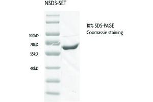 Recombinant WHSC1L1 / NSD3 - SET protein gel.
