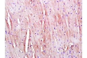 Paraformaldehyde-fixed, paraffin embedded Mouse heart, Antigen retrieval by boiling in sodium citrate buffer (pH6. (Kelch-Like 24 antibody  (AA 1-100))