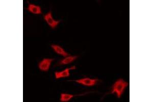 ABIN6274942 staining HeLa by IF/ICC. (ARPP21 antibody  (Internal Region))