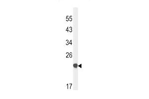 Claudin 23 antibody  (C-Term)