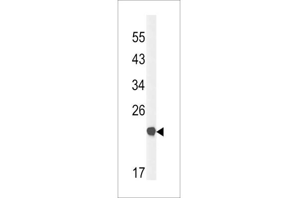 Claudin 23 antibody  (C-Term)