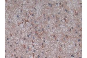 Immunohistochemistry (IHC) image for anti-Complement Component 5a (C5a) (AA 678-751) antibody (ABIN7442321)