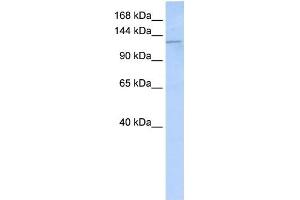 Desmoglein 2 antibody used at 1 ug/ml to detect target protein. (Desmoglein 2 antibody  (N-Term))