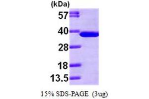 SDS-PAGE (SDS) image for N-Ethylmaleimide-Sensitive Factor Attachment Protein, alpha (NAPA) (AA 1-295) protein (His tag) (ABIN667207) (NAPA Protein (AA 1-295) (His tag))