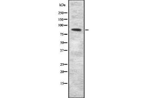 Western blot analysis SEMA3F using COLO205 whole cell lysates (SEMA3F antibody  (C-Term))