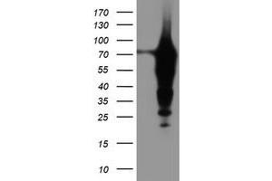 HEK293T cells were transfected with the pCMV6-ENTRY control (Left lane) or pCMV6-ENTRY EPN2 (Right lane) cDNA for 48 hrs and lysed. (Epsin 2 antibody)