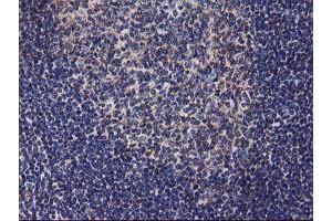 Image no. 3 for anti-Diacylglycerol Kinase, alpha 80kDa (DGKA) antibody (ABIN1497815) (DGKA antibody)