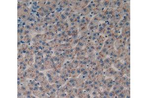IHC-P analysis of liver tissue, with DAB staining. (DDR1 antibody  (AA 568-829))