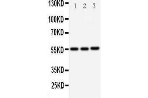 Western Blotting (WB) image for anti-Kallikrein 2 (KLK2) (AA 243-261), (C-Term) antibody (ABIN3043140) (Kallikrein 2 antibody  (C-Term))