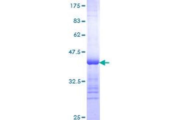 Thyroglobulin Protein (TG) (AA 2659-2768) (GST tag)