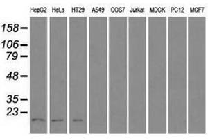 Image no. 2 for anti-Cancer/testis Antigen 1B (CTAG1B) antibody (ABIN1499904) (CTAG1B antibody)