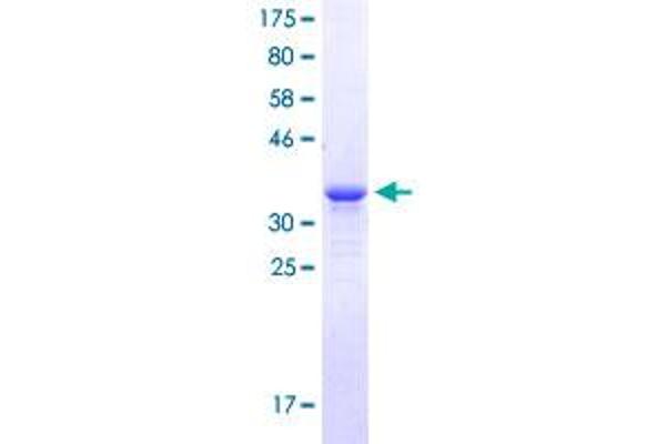 Vasopressin Protein (AA 20-124) (GST tag)