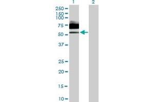 Western Blot analysis of IL6R expression in transfected 293T cell line by IL6R MaxPab polyclonal antibody. (IL-6 Receptor antibody  (AA 1-468))