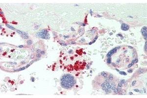 #VALUE! (CD42b antibody  (AA 19-291))