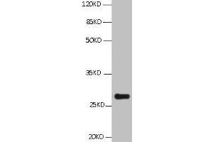 All Lanes:Mouse anti BCL2L1 Monoclonal antibody at 1 μg/mL Lane 1:HepG2 whole cell lysate Secondary Goat polyclonal to Mouse IgG at 1/5000 dilution Predicted band size:26,27,19kd Observed band size:26KD (BCL2L1 antibody)