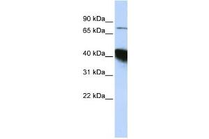 Western Blotting (WB) image for anti-CBP80/20-Dependent Translation Initiation Factor (CTIF) antibody (ABIN2458532) (CTIF/KIAA0427 antibody)