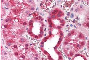 Human Kidney (formalin-fixed, paraffin-embedded) stained with ZFP36 antibody ABIN214153 at 5 ug/ml followed by biotinylated goat anti-rabbit IgG secondary antibody ABIN481713, alkaline phosphatase-streptavidin and chromogen. (ZFP36 antibody  (AA 84-133))