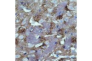 Immunohistochemical analysis of GAP43 staining in rat brain formalin fixed paraffin embedded tissue section. (GAP43 antibody)